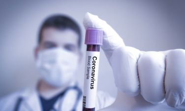 Działania ZPUE S.A. w czasach epidemii koronawirusa (COVID-19)
